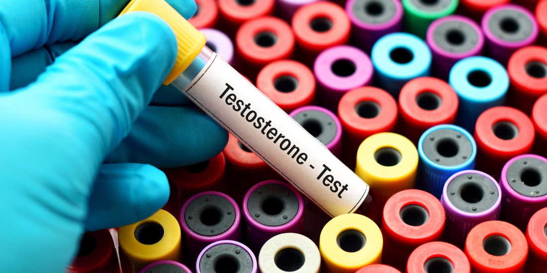 What May Cause Low Testosterone?